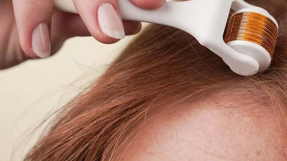 Derma roller pentru creșterea părului: cum funcționează și când dă rezultate, potrivit specialiștilor