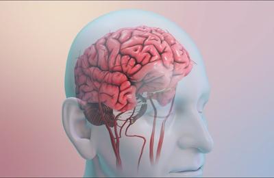 Poți face accident vascular cerebral de la o simplă ceartă? Iată 10 lucruri care țin AVC-urile la distanță