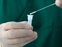 COVID-19 ar putea reactiva virusuri ascunse ani de zile în organism. Ce au observat cercetătorii