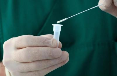 COVID-19 ar putea reactiva virusuri ascunse ani de zile în organism. Ce au observat cercetătorii