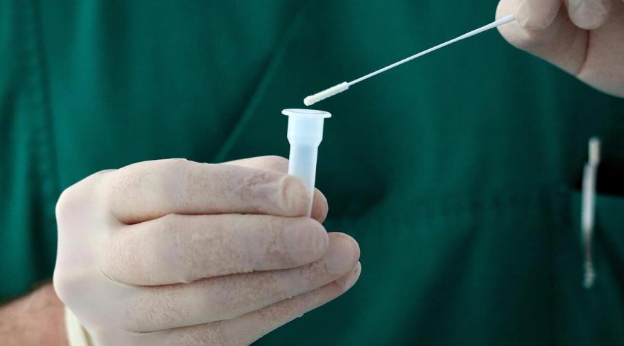 COVID-19 ar putea reactiva virusuri ascunse ani de zile în organism. Ce au observat cercetătorii