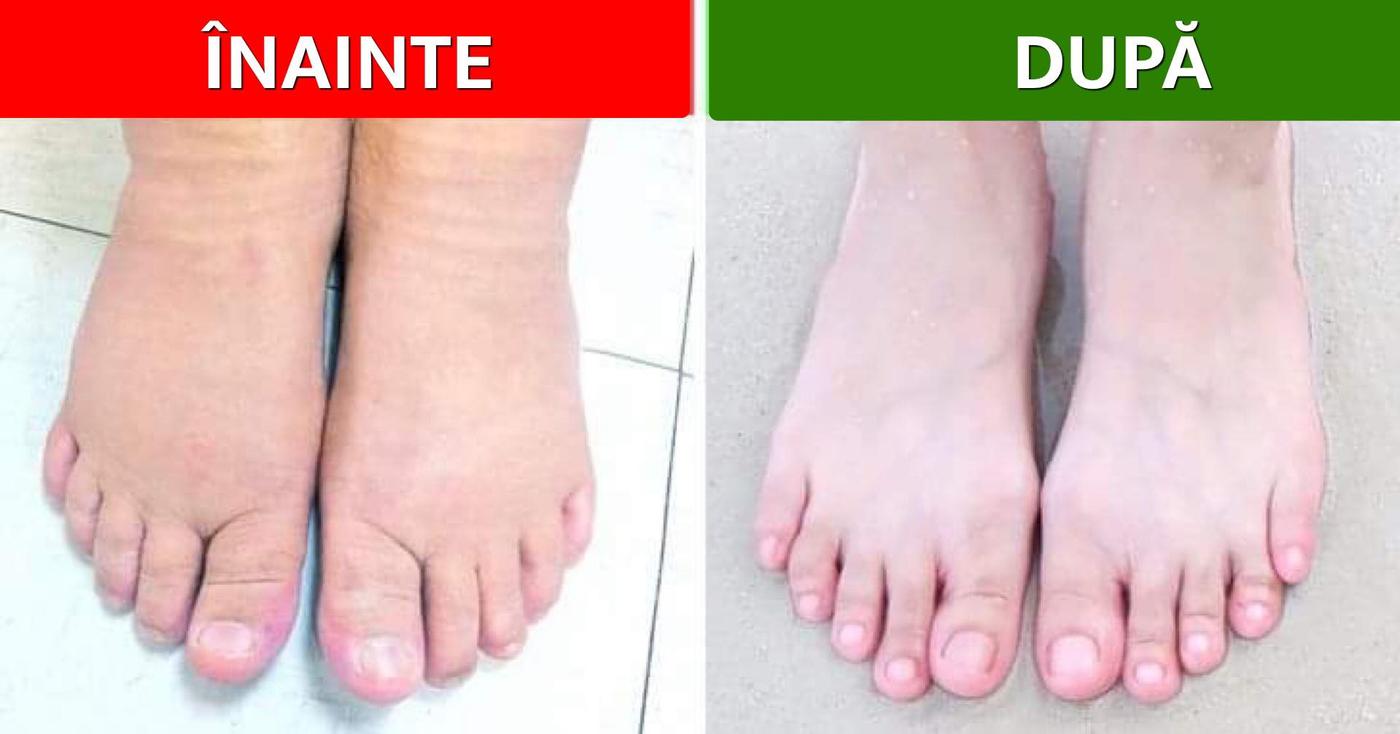 10 Tipuri de băi pentru picioare și ce probleme de sănătate pot rezolva