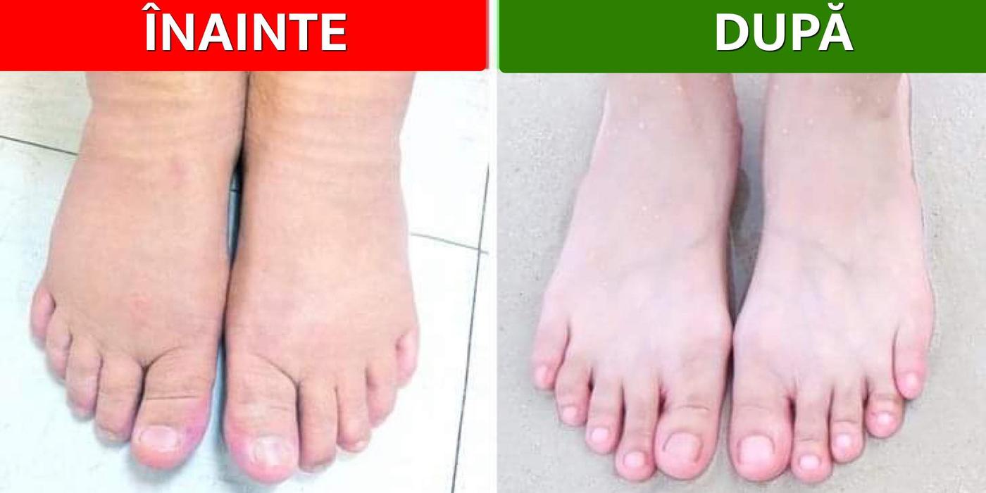10 Tipuri de băi pentru picioare și ce probleme de sănătate pot rezolva
