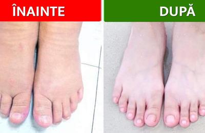 10 Tipuri de băi pentru picioare și ce probleme de sănătate pot rezolva
