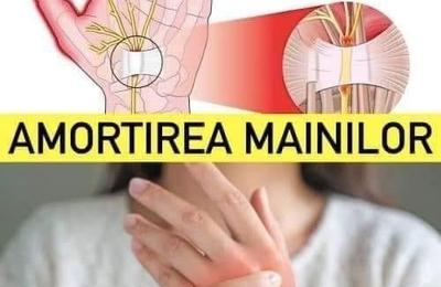 Amorțirea mâinilor – un semnal important că trebuie să mergeți la medic. 5 cauze posibile