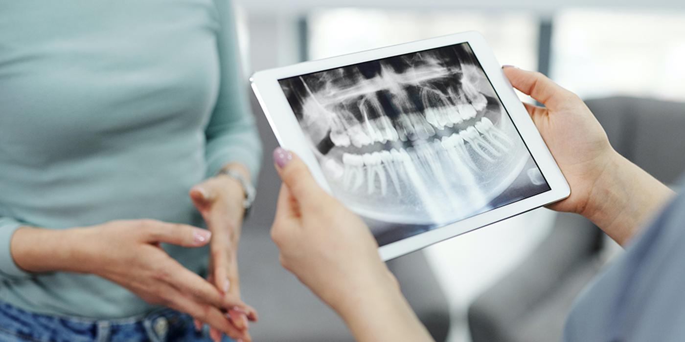 Radiografia dentară – ce trebuie să știi despre această investigație