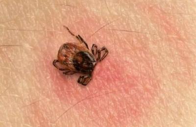 Un nou virus se răspândește în toată Europa, purtat de căpușe