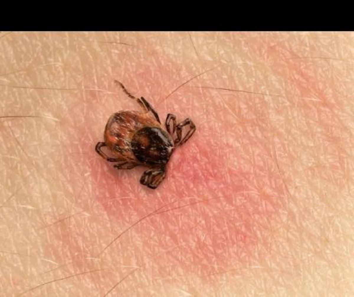 Cum ne apărăm de căpușe, marea problemă în anotimpul cald. Există mai multe soluții pentru protecție