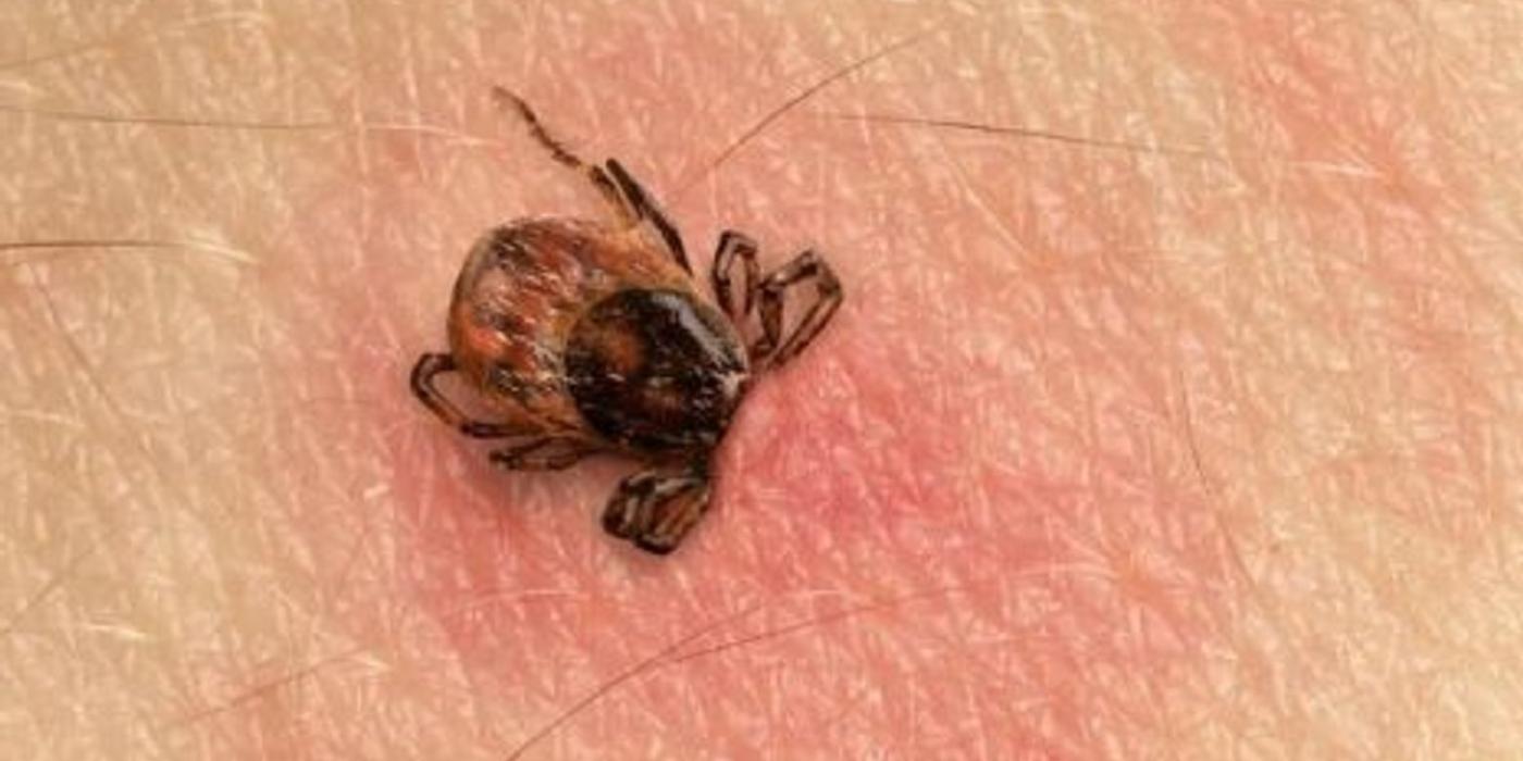 Cum ne apărăm de căpușe, marea problemă în anotimpul cald. Există mai multe soluții pentru protecție