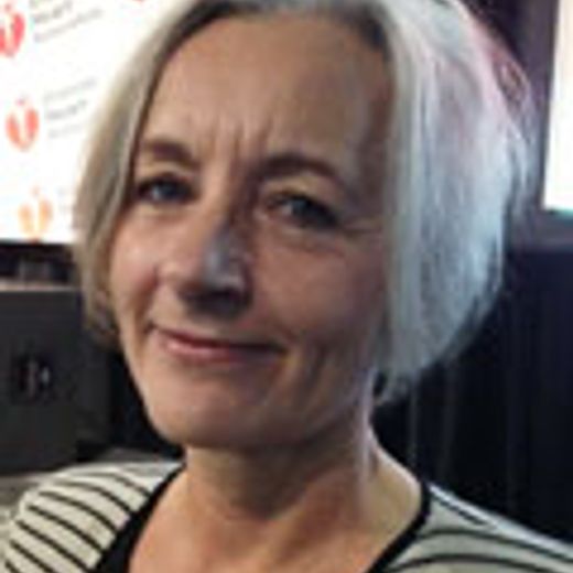 Aging signs predict coronary risk independently of chronological age