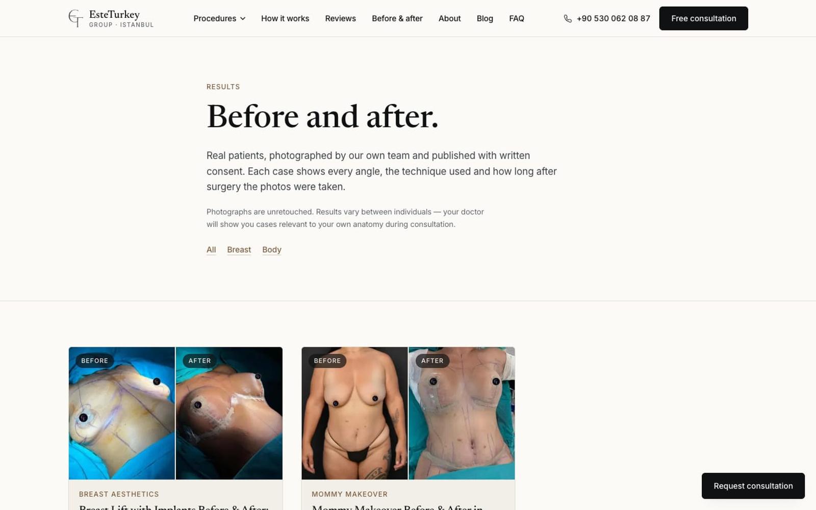 EsteTurkey Group before and after page, desktop view
