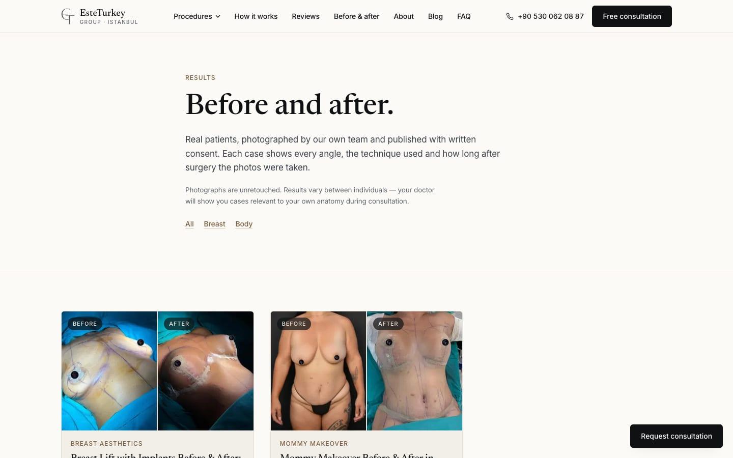 EsteTurkey Group before and after page, desktop view