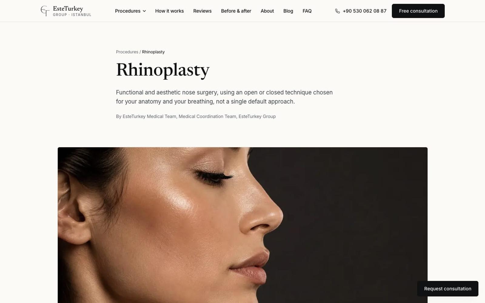 EsteTurkey Group rhinoplasty procedure page, desktop view