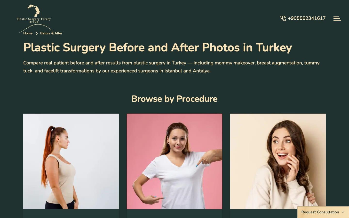 Plastic Surgery Turkey Group before and after page, desktop view