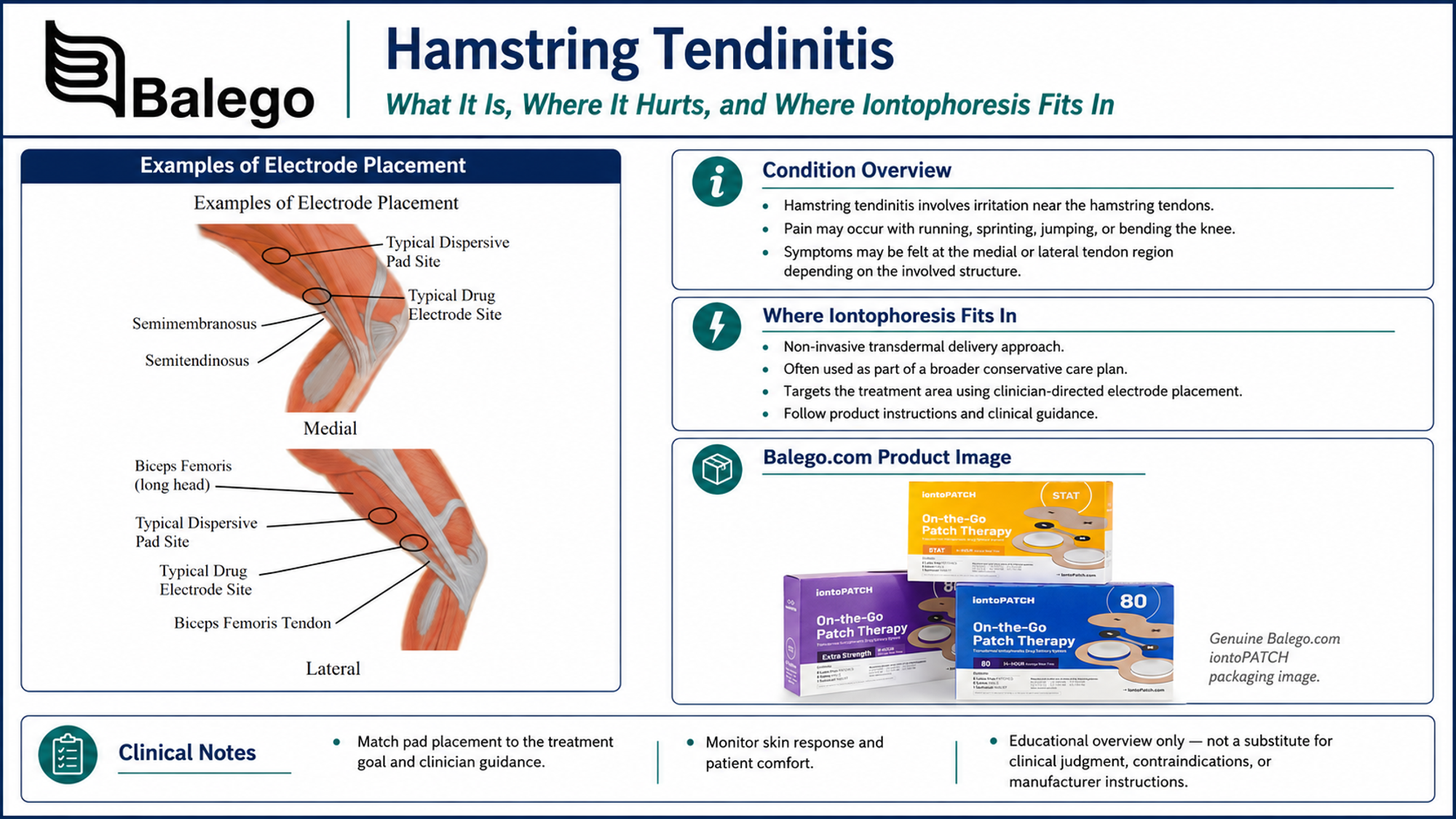 Hamstring tendinopathy compared with muscle strain tendon tear and sciatic nerve pain