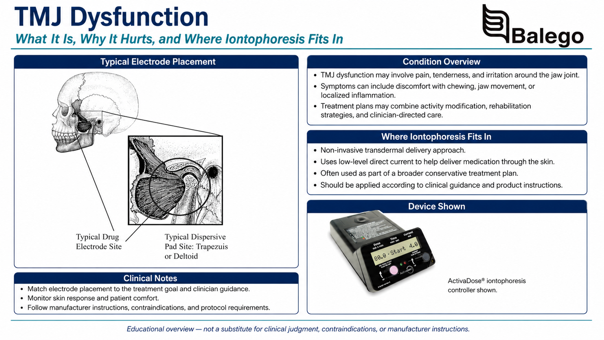 Unilateral TMJ iontophoresis electrode anterior to the tragus with ipsilateral shoulder return electrode
