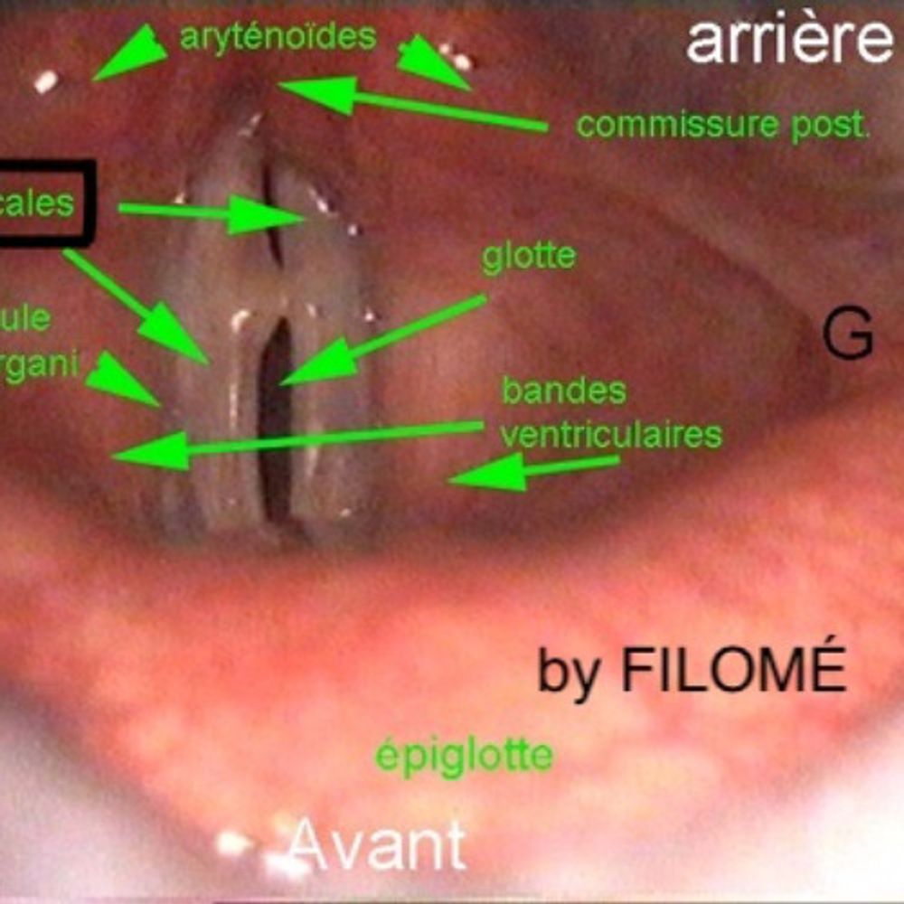 Show image