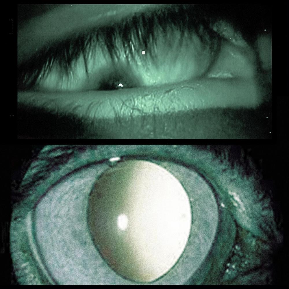 Show image