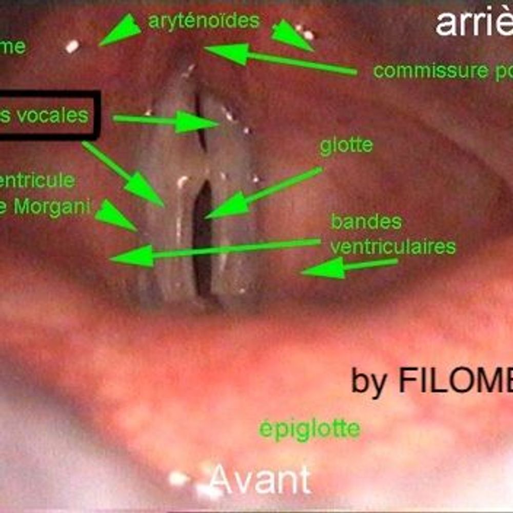 Show image