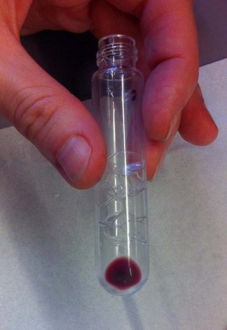 AR3FS membrane vesicles