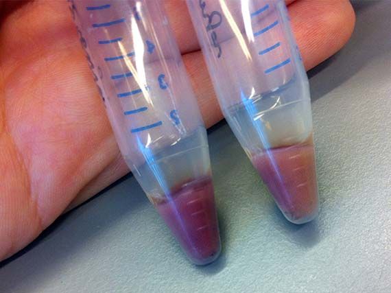 AR3 E.coli cultures showing purple shift in colour