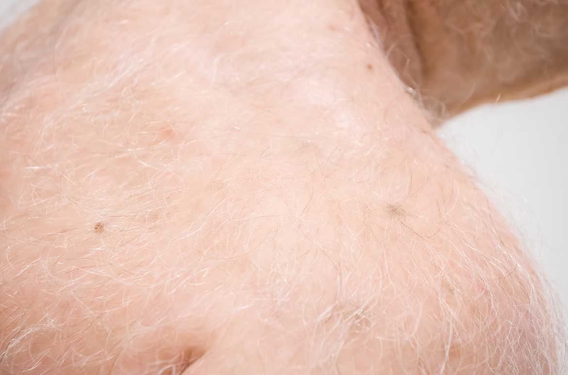 Patricia Piccinini, Australia b.1965 / The Carrier 2012 / Silicone, fibreglass, human hair, animal fur / ed. 1/1 + 1 AP / 170 x 115 x 75cm / Lyon Collection, Lyon Housemuseum, Melbourne / © The artist