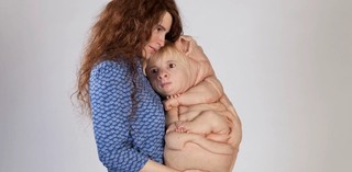 Patricia Piccinini / Australia VIC b.1965 / The Bond 2016 / Silicone, fibreglass, human hair, clothing / 162 x 56 x 50cm / Courtesy the artist, Tolarno Galleries, Melbourne; Roslyn Oxley9 Gallery, Sydney; and Hosfelt Gallery, San Francisco