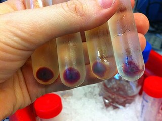 Bright purple AR3 proteins extracted as membrane vesicles