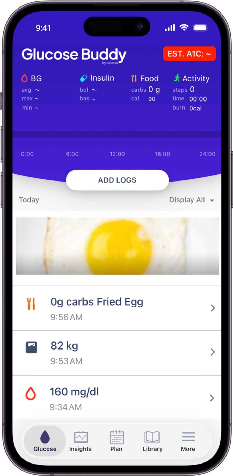 Glucose Buddy home screen showing blood glucose, insulin, food, and activity summaries above the day's log