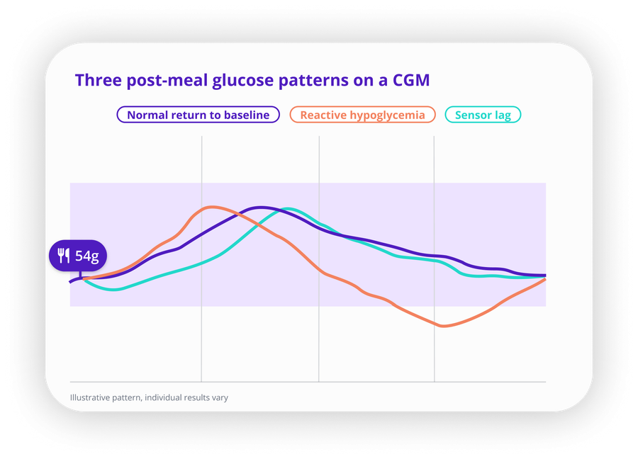 Three post-meal glucose patterns on a CGM: a normal return to baseline, a sensor-lag artifact, and a reactive-hypoglycemia dip.