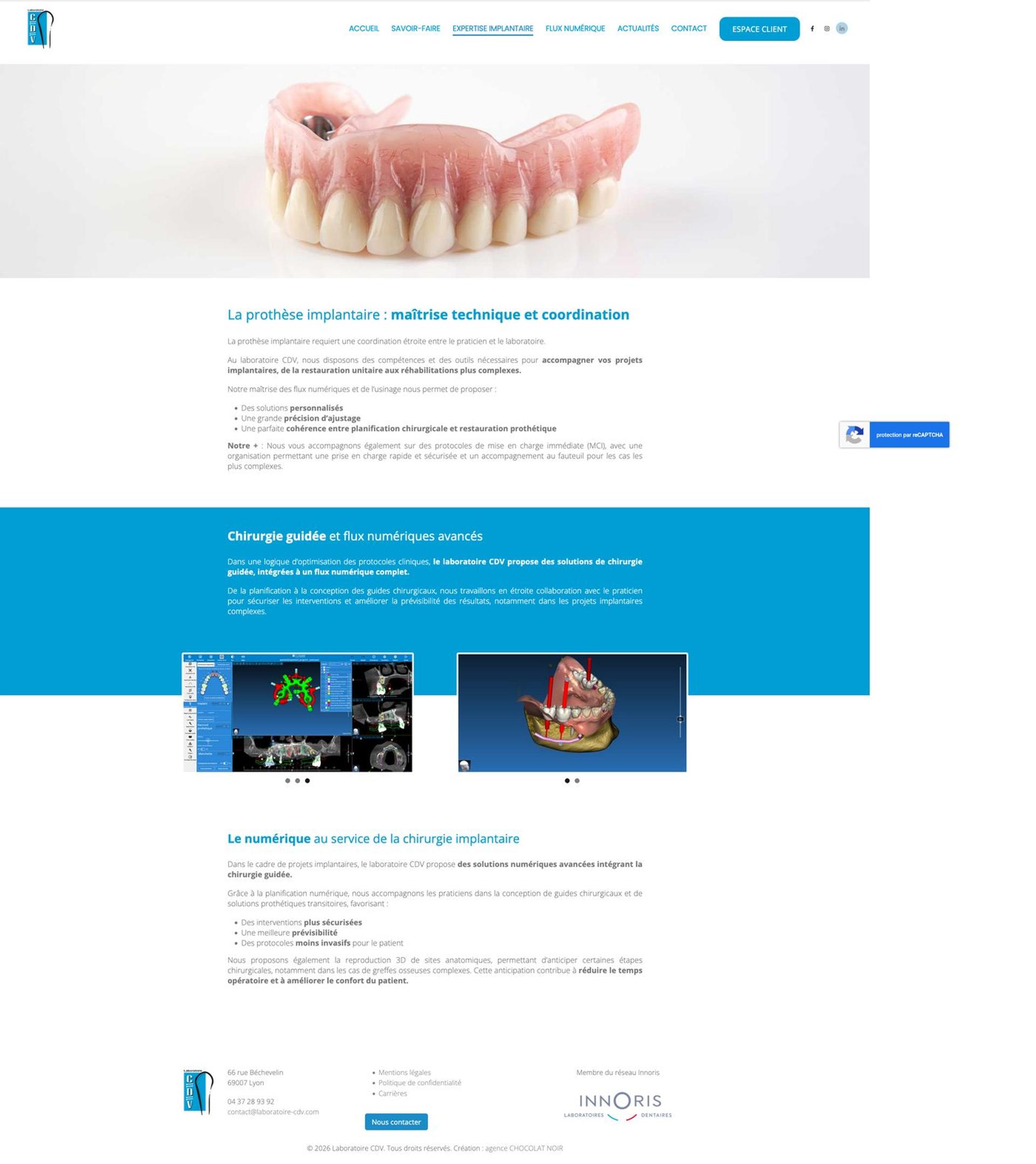 Page Expertise implantaire — Laboratoire CDV