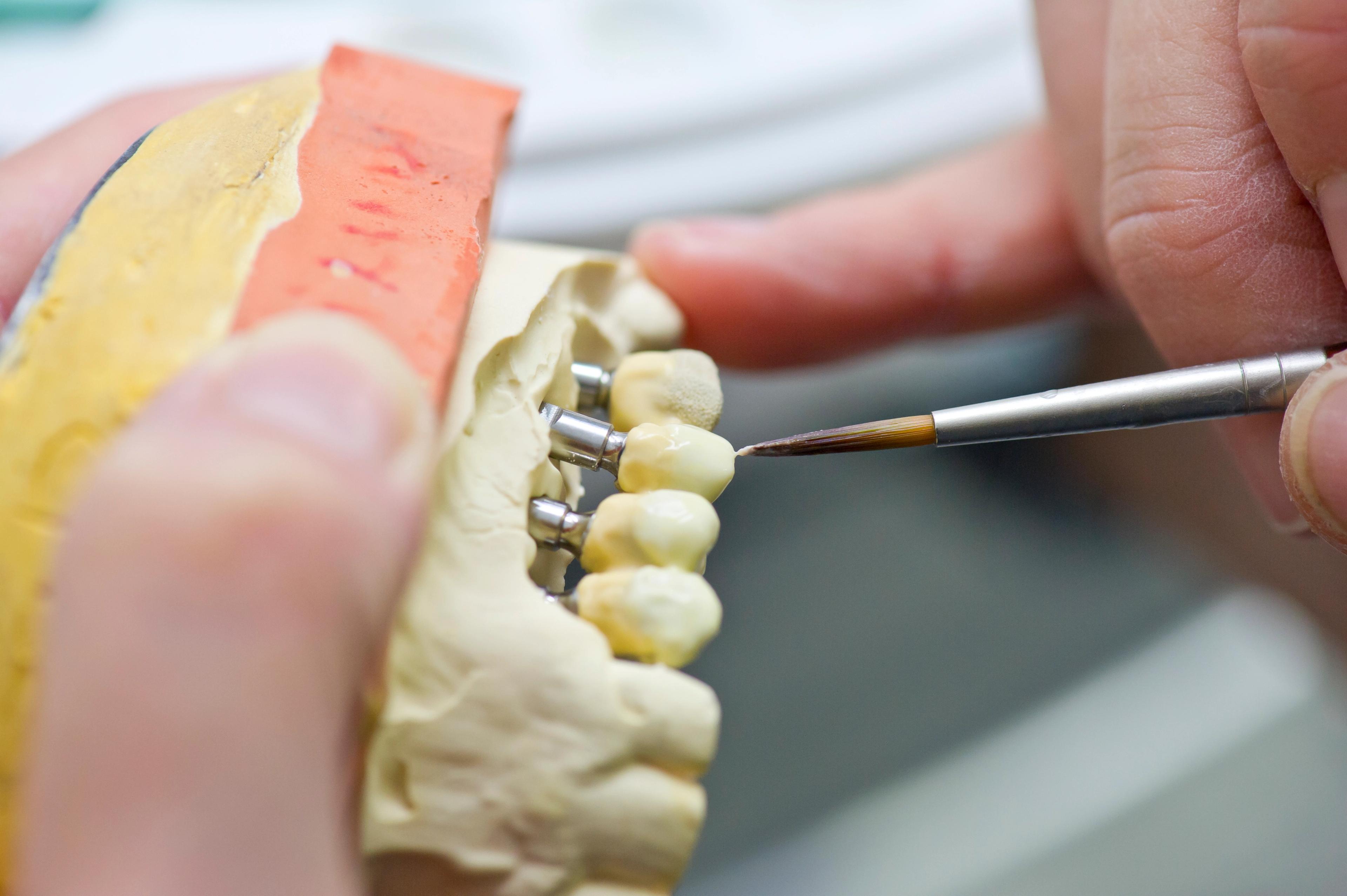 DURODEZ : reportage photo laboratoire dentaire