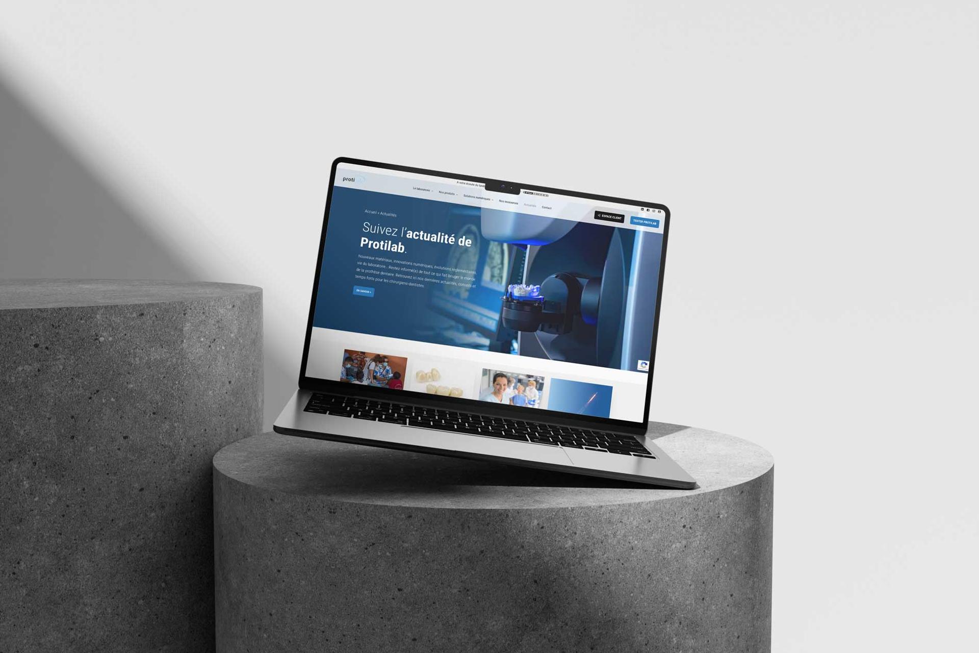 Découvrez comment l’agence Chocolat Noir a conçu le nouveau site internet de Protilab, laboratoire dentaire innovant. Une réalisation sur mesure pour une expérience utilisateur optimale et une visibilité renforcée.