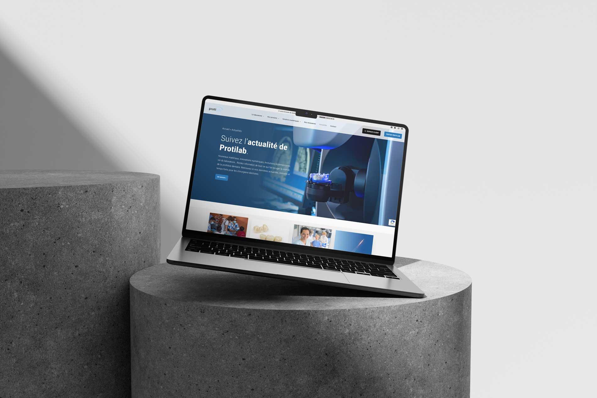 Découvrez comment l’agence Chocolat Noir a conçu le nouveau site internet de Protilab, laboratoire dentaire innovant. Une réalisation sur mesure pour une expérience utilisateur optimale et une visibilité renforcée.