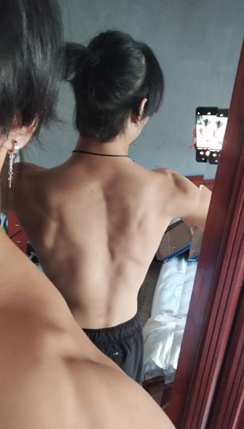 Antes