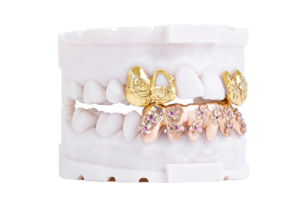A pair of white denchers with gold and rose-gold grills.