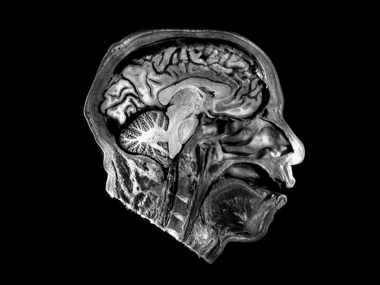 An MRI of the human brain.