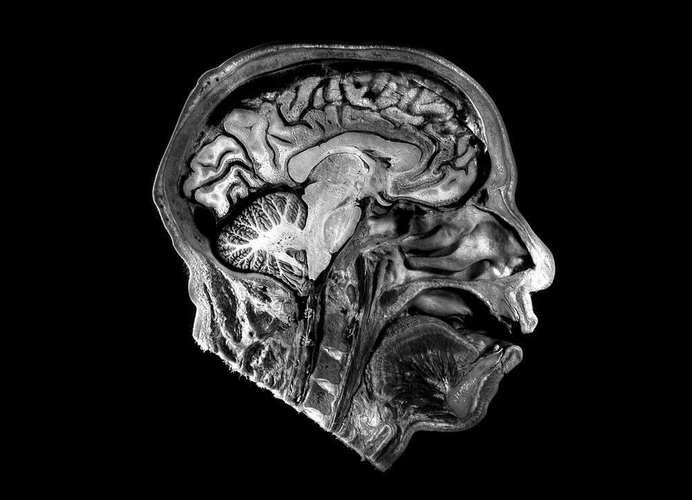 An MRI of the human brain.