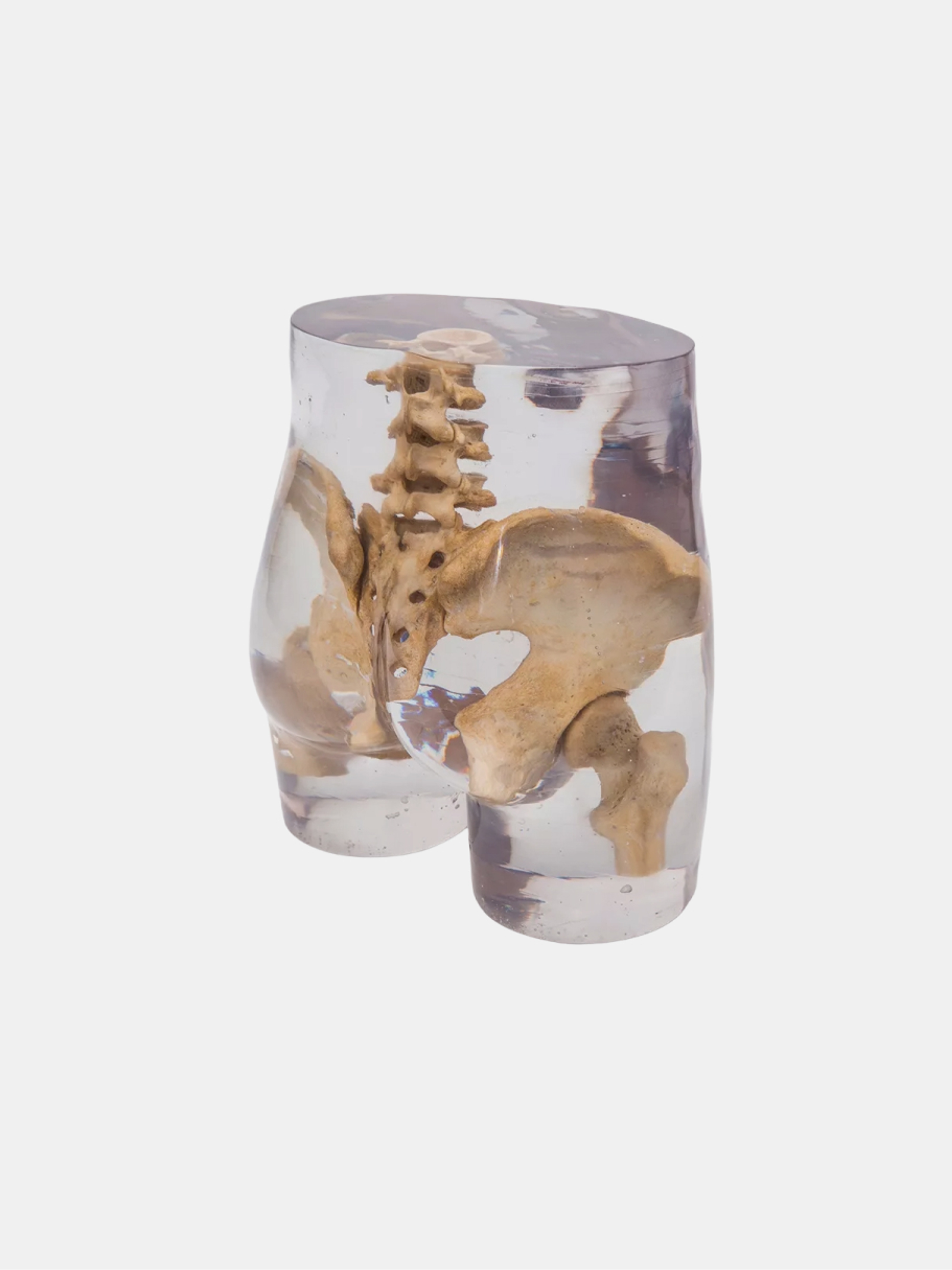 X-Ray Phantom Pelvis Transparent