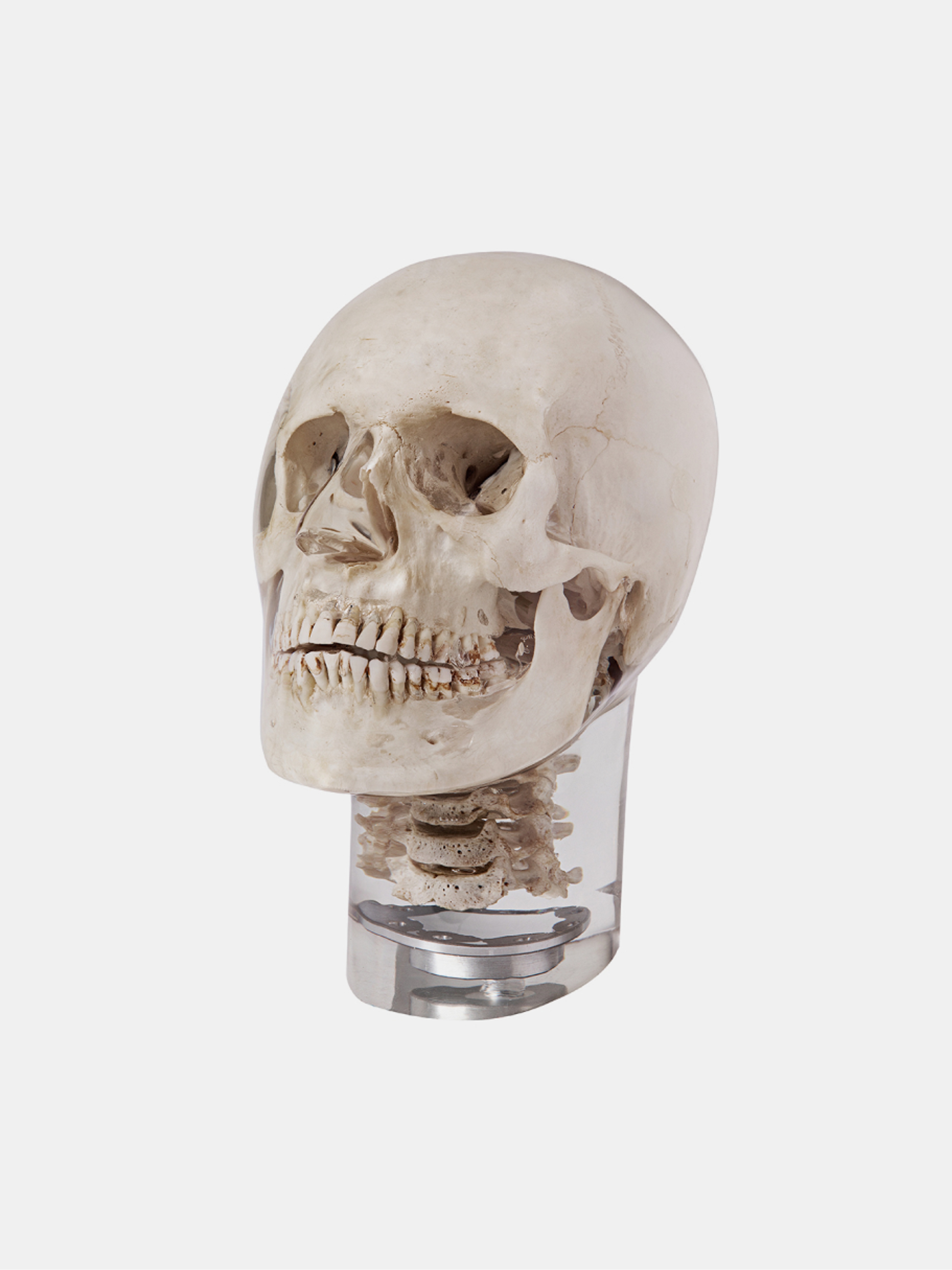X-ray phantom head with cervical vertebrae, transparent