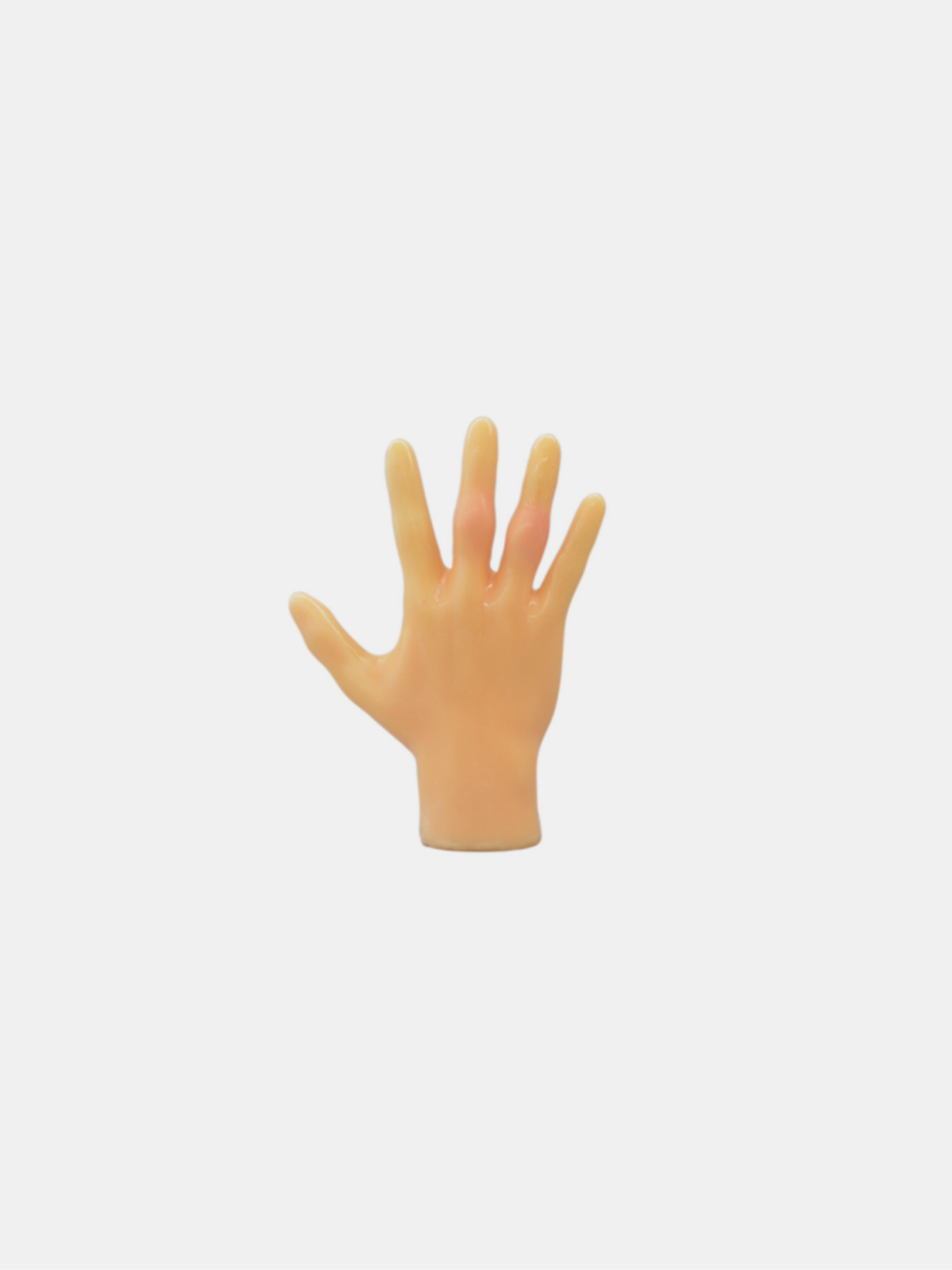 Rheumatoid Hand Ultrasound Phantom (US-17)