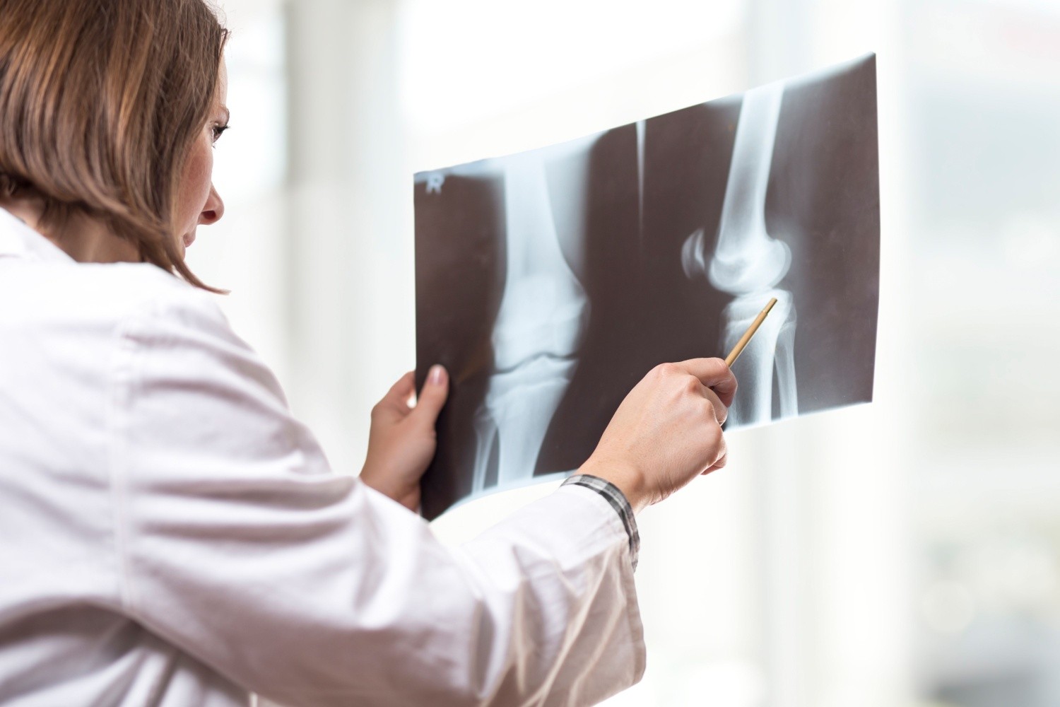 Osteoporosis