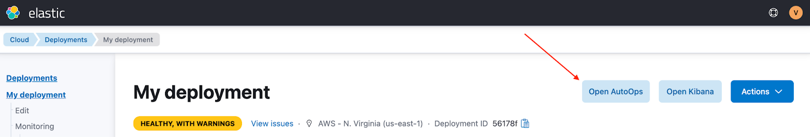 The “Open AutoOps” button