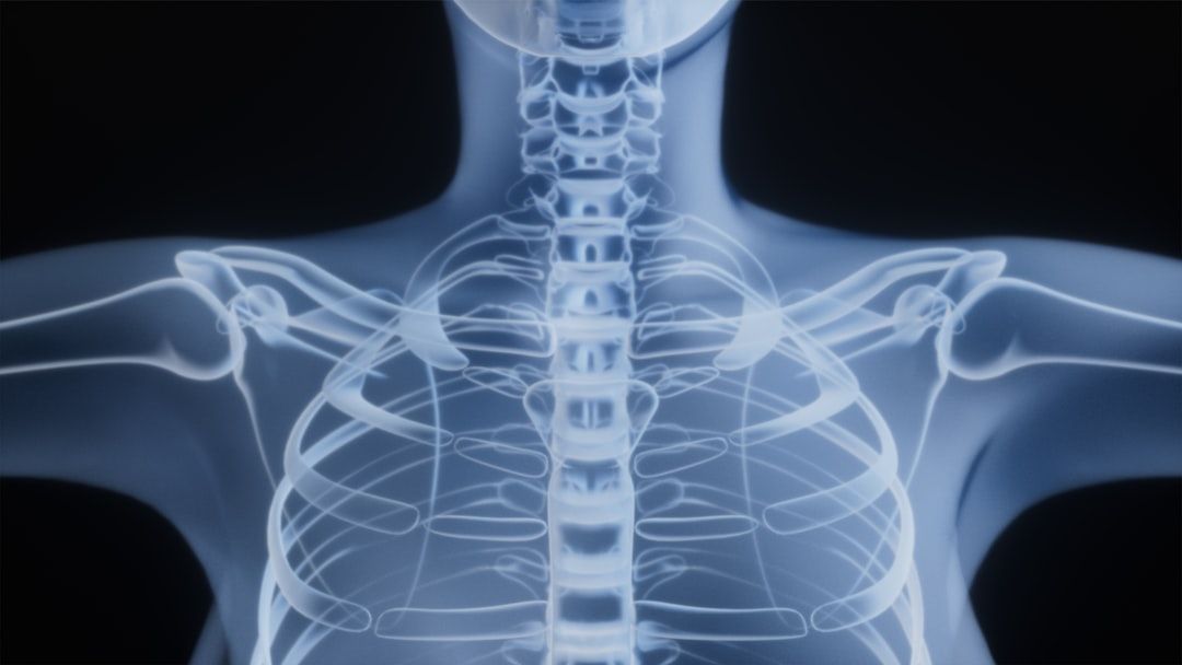 This image displays an X-ray view of a human chest, highlighting the ribcage and the associated skeletal structure. The focus is on the spine, collarbones, and ribs, set against a dark background.