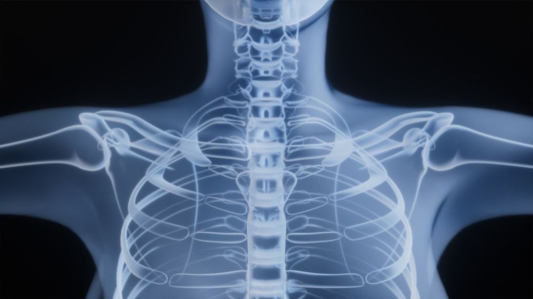 This image displays an X-ray view of a human chest, highlighting the ribcage and the associated skeletal structure. The focus is on the spine, collarbones, and ribs, set against a dark background. — Credit: Photo by Rohit Choudhari on Unsplash