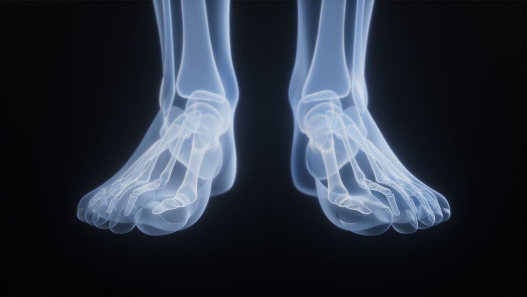 The image features a close-up of an X-ray representation of two human feet, highlighting the skeletal structure. The translucent bones are displayed against a dark background, emphasizing the intricate details of the foot anatomy.