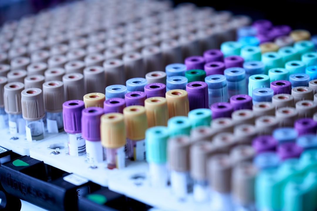 The image features multiple rows of laboratory test tubes, each with colored caps, indicating various types of samples ready for analysis. The focus is on the organization and arrangement of the tubes, which are typical in medical testing environments.