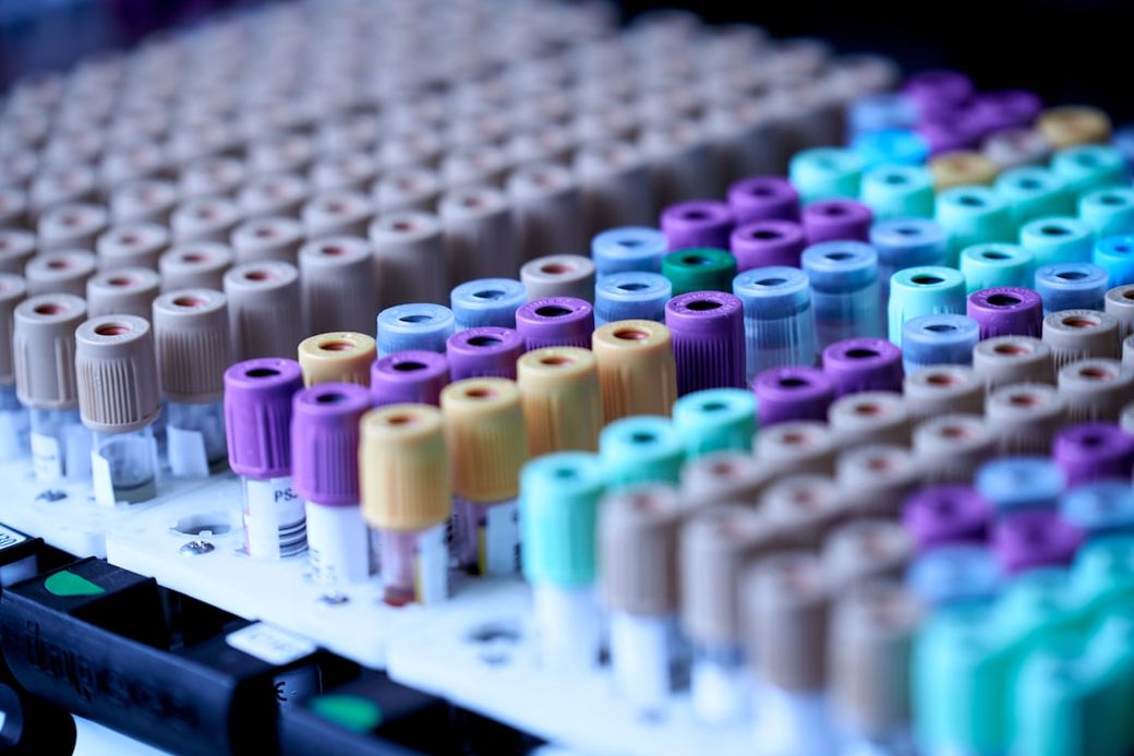 The image features multiple rows of laboratory test tubes, each with colored caps, indicating various types of samples ready for analysis. The focus is on the organization and arrangement of the tubes, which are typical in medical testing environments. — Credit: Photo by Testalize.me on Unsplash
