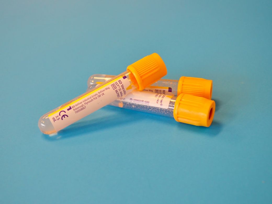 The image displays several laboratory test tubes with yellow caps, placed against a bright blue background. These tubes are typically used for collecting blood or other biological samples. — Credit: Photo by Testalize.me on Unsplash