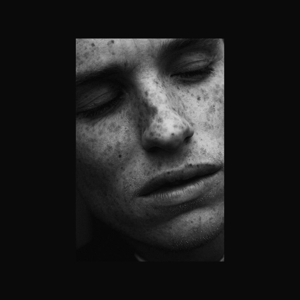 A black-and-white close-up of a face with freckles and closed eyes